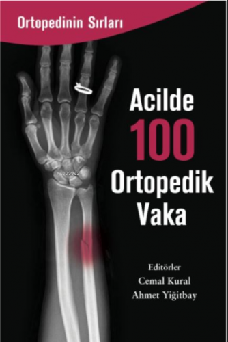 Acilde 100 Ortopedi Vaka | Cemal Kural | Zinde Yayınevi