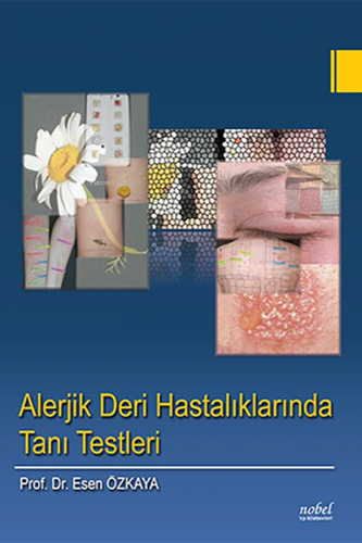 Alerjik Deri Hastalıklarında Tanı Testleri | Esen Özkaya | Nobel Tıp K