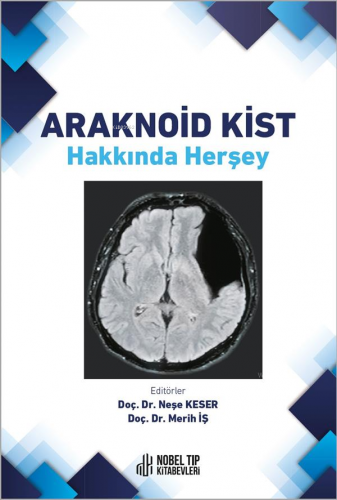 Araknoid Kist Hakkında Herşey | Neşe Keser | Nobel Tıp Kitabevi