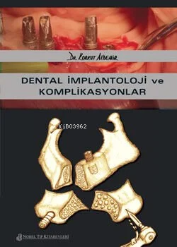 Dental İmplantoloji Ve Komplikasyonlar | Korkut Aldemir | Nobel Tıp Ki