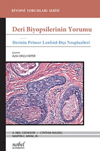 Deri Biyopsilerinin Yorumu: Derinin Primer Lenfoid-Dışı Neoplazileri |