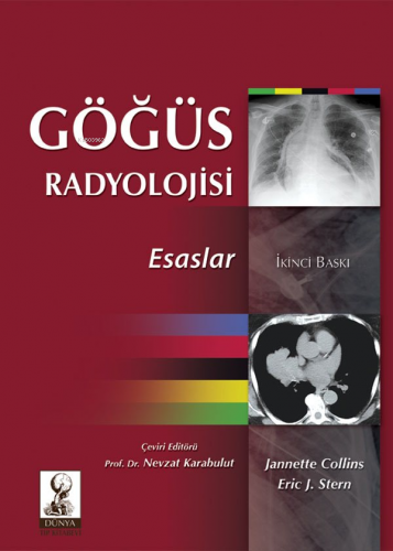 Göğüs Radyolojisi:Esaslar | Eric J. Stern | Dünya Tıp Kitabevi