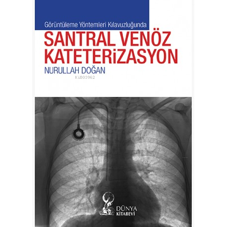 Görüntüleme Yöntemleri Kılavuzluğunda Santral Venöz Kateterizasyon | N