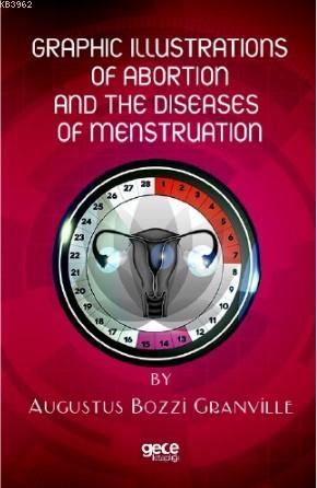 Graphic İllustrations Of Abortion And The Diseases Of Menstruation | A