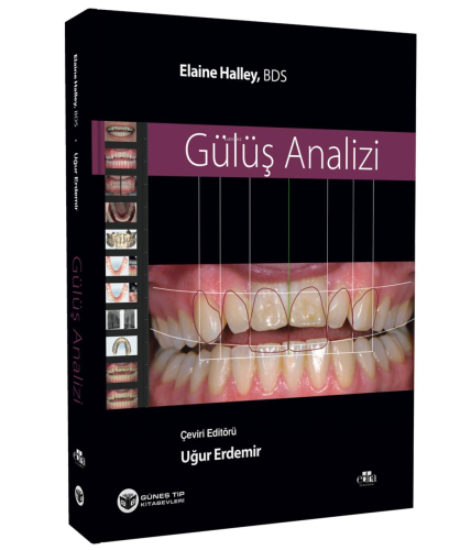 Gülüş Analizi | Elaine Halley | Güneş Tıp Kitabevi