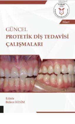 Güncel Protetik Diş Tedavisi Çalışmaları ( Aybak 2020 Mart ) | Bülent 