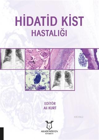 Hidatid Kist Hastalığı | Ali Kurt | Akademisyen Kitabevi