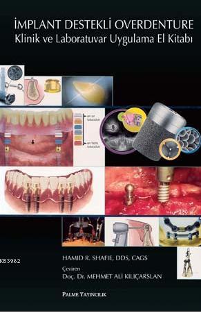 İmplant Destekli Overdenture Klinik ve Laboratuvar Uygulama El Kitabı 