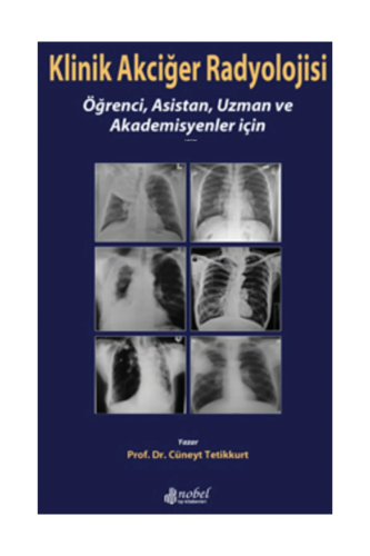 Klinik Akciğer Radyolojisi | Cüneyt Tetikkurt | Nobel Tıp Kitabevi