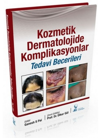 Kozmetik Dermatolojide Komplikasyonlar:Tedavi Becerileri | Ülker Gül |