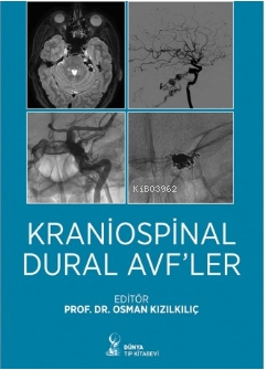 Kraniospinal Dural Avfler | Osman Kızılkılıç | Dünya Tıp Kitabevi