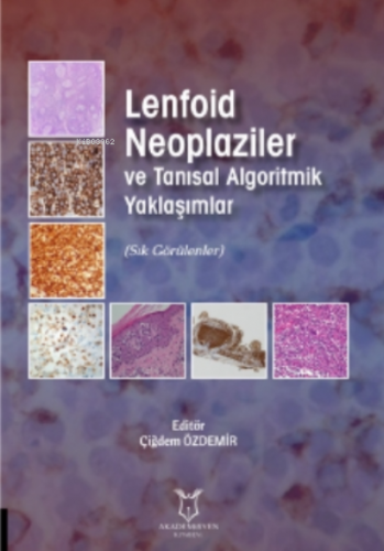 Lenfoid Neoplaziler ve Tanısal Algoritmik Yaklaşımlar | Çiğdem Özdemir