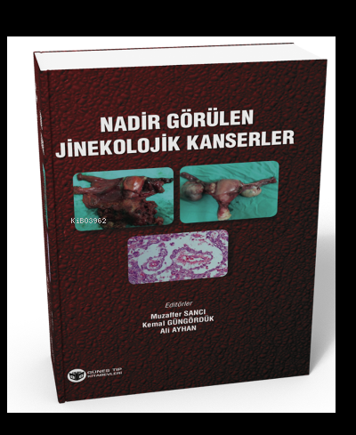 Nadir Görülen Jinekolojik Kanserler | Ali Ayhan | Güneş Tıp Kitabevi