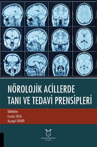 Nörolojik Acillerde Tanı ve Tedavi Prensipleri | Ayşegül Demir | Akade