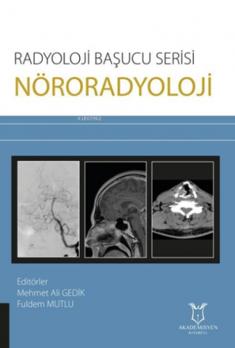 Nöroradyoloji - Radyoloji Başucu Serisi | Mehmet Ali Gedik | Akademisy