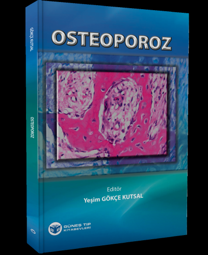 Osteoporoz | Yeşim Gökçe Kutsal | Güneş Tıp Kitabevi