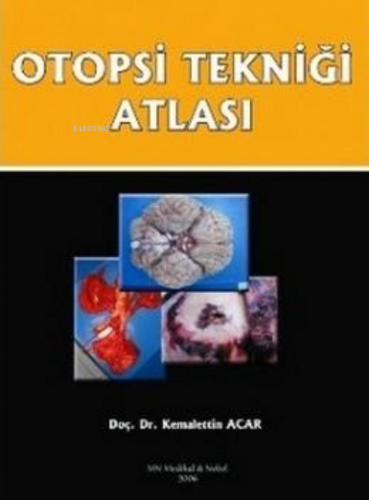 Otopsi Tekniği Atlası | Kemallettin Acar | Medikal Network Nobel Kitab