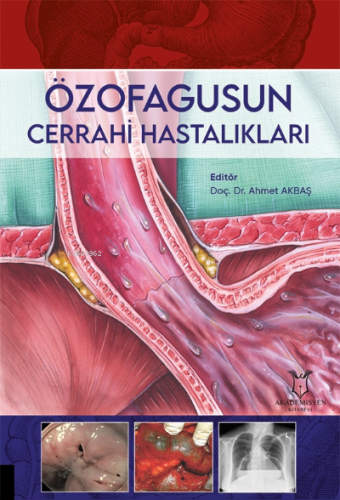 Özofagusun Cerrahi Hastalıkları | Ahmet Akbaş | Akademisyen Kitabevi