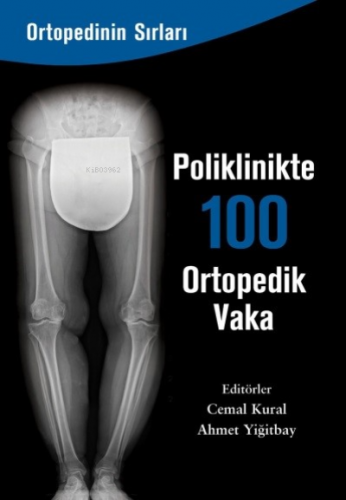 Poliklinkte 100 Ortopedik Vaka | Cemal Kural | Zinde Yayınevi