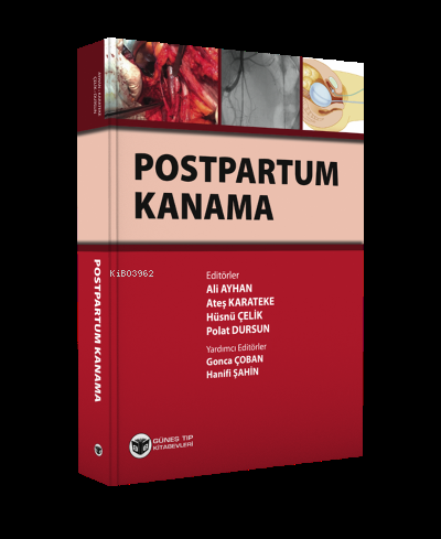 Postpartum Kanama | Kolektif | Güneş Tıp Kitabevi