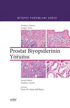 Prostat Biyopsilerinin Yorumu | Saime Gül Barut | Nobel Tıp Kitabevi