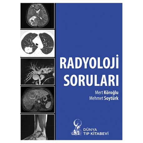 Radyoloji Soruları | Mert Köroğlu | Dünya Tıp Kitabevi