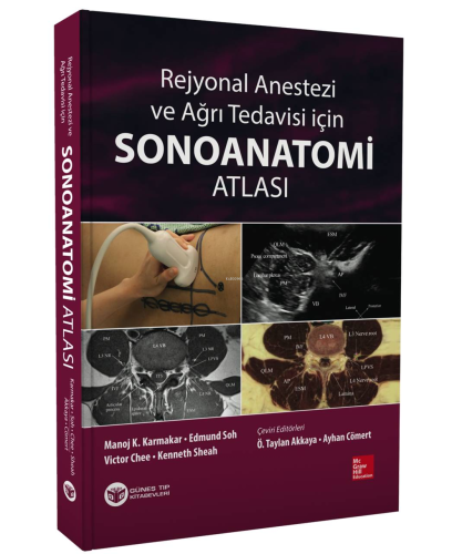 Rejyonal Anestezi ve Ağrı Tedavisi İçin Sonoanatomi Atlası | Manoj K. 