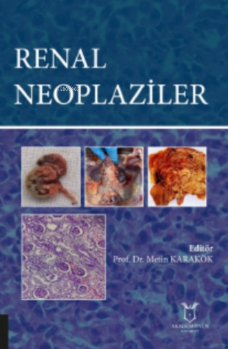 Renal Neoplaziler | Renal Neoplaziler | Akademisyen Kitabevi