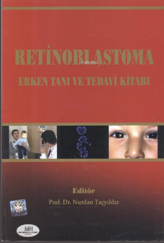 Retinoblastoma Erken Tanı ve Tedavi | Nurdan Taçyıldız | Medikal Netwo