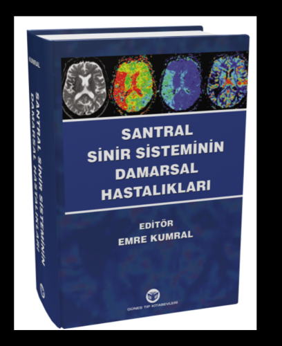 Santral Sinir Sisteminin Damarsal Hastalıkları | Emre Kumral | Güneş T