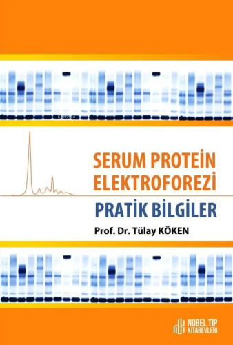 Serum Protein Elektroforezi - Pratik Bilgiler | Tülay Köken | Nobel Tı