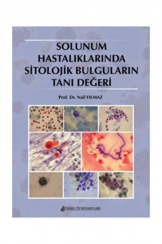 Solunum Hastalıklarında Sitolojik Bulguların Tanı Değeri | Nail Yılmaz