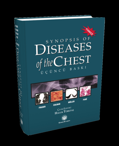 Synopsis of Diseases of The Chest (Türkçesi) | Richard S. Fraser | Gün