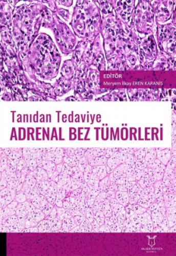 Tanıdan Tedaviye Adrenal Bez Tümörleri | Meryem İlkay Eren Karanis | A