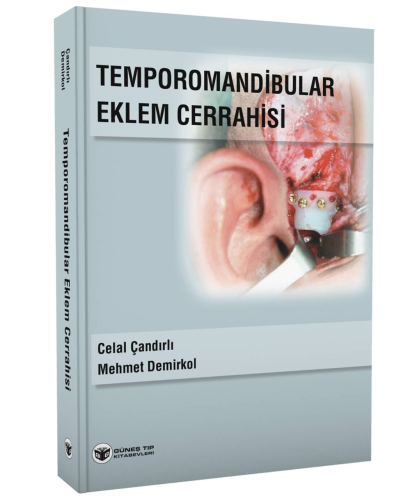 Temporomandibular Eklem Cerrahisi | Mehmet Demirkol | Güneş Tıp Kitabe