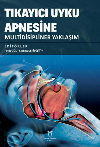 Tıkayıcı Uyku Apnesine Multidisipliner Yaklaşım | Fatih Gül | Akademis