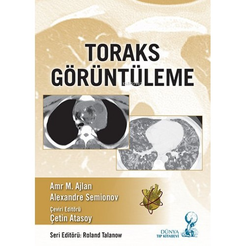 Toraks Görüntüleme | Çetin Atasoy | Dünya Tıp Kitabevi