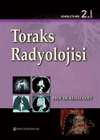 Toraks Radyolojisi | Kemal Ödev | Nobel Tıp Kitabevi