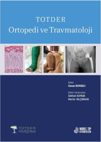 Totder Ortopedi Ve Travmatoloji | Hasan Bombacı | Nobel Tıp Kitabevi