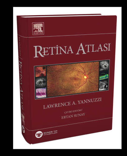 Yannuzzi Retina Atlası | Lawrence A. Yannuzzi | Güneş Tıp Kitabevi